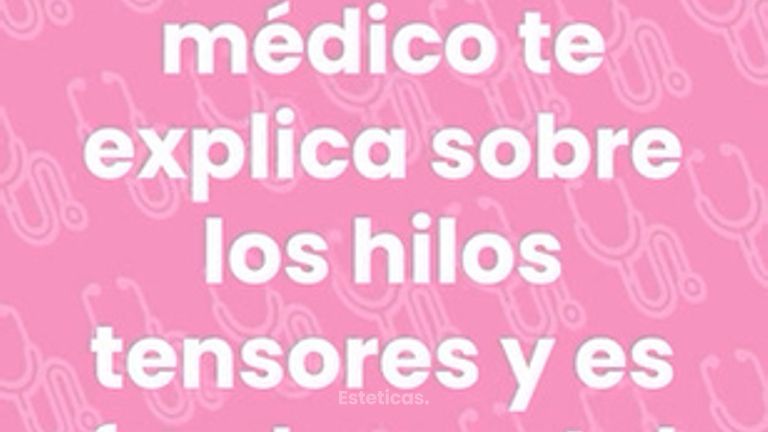 Hilos tensores y es fundamental que lo sepas - Dra. Jimena D. Frasso