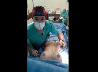 Lipoescultura - Dr. Damián Galeazzo