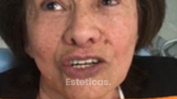 Testimonial - Implantes Dentales