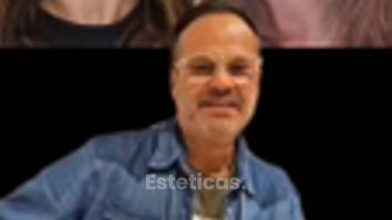 Lifting Facial - Dr. Matias Llabres