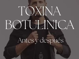 Toxina botulínica - Dra. Jimena D. Frasso