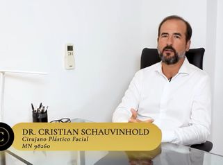 Rinoplastia reconstructiva - Dr. Cristian Schauvinhold