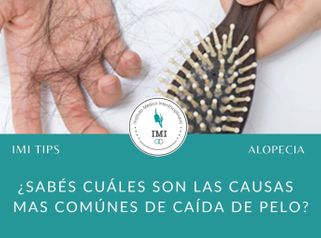 Tipos de Alopecia - Dra María José Lukacs y Dr Jose Luis Ava