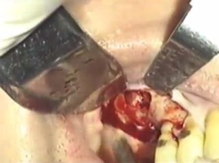 Acaba con tu problema dental