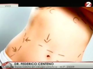 DR CENTENO LIPOASPIRACIÓN
