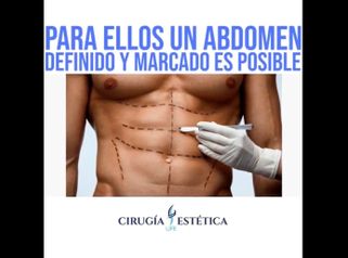 Abdominoplastia 