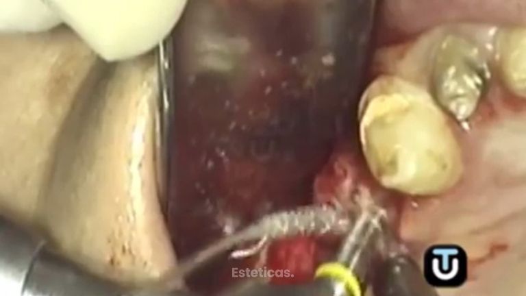 Arregla tu problema dental