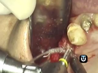 Arregla tu problema dental