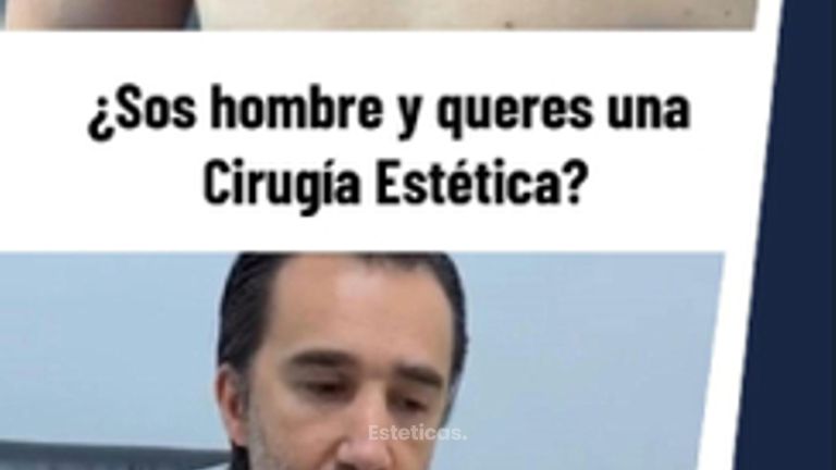 Cirugías estéticas hombres - Dr. Damián Galeazzo y Equipo