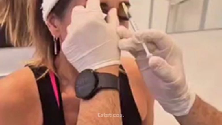 Botox - Dr. Matías Llabres