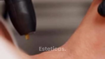 ¿Y si el futuro del rejuvenecimiento fuera regenerar sin dañar? - Dra. Jimena D. Frasso