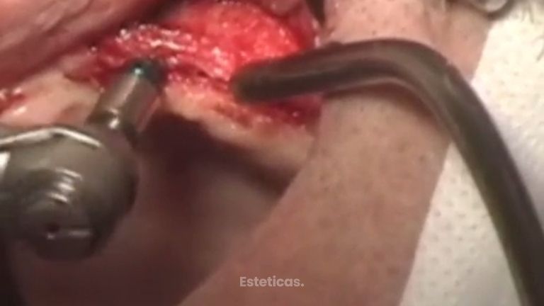 Consigue la sonrisa que siempre deseaste