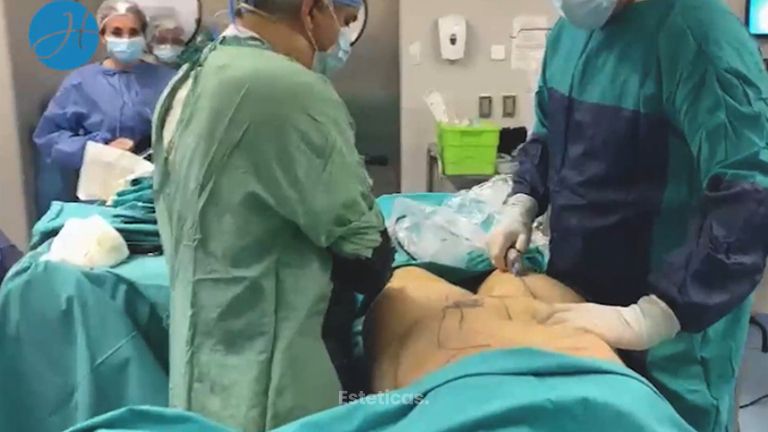 Porqué elegir Micro Aire? - Dr. Honorio Labaronnie