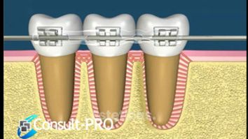 Ortodoncia - Dental Advance