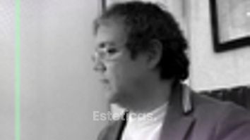 Adiposidad localizada. - Bioestética Group