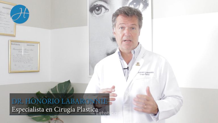 Liposucción de brazos - Dr. Honorio Labaronnie
