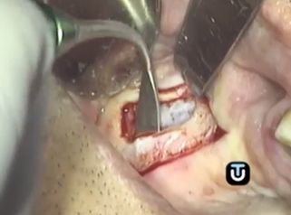 Soluciona tu problema dental
