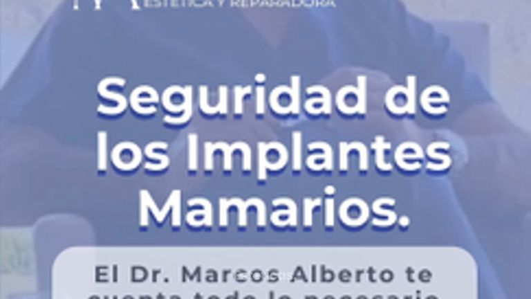 Aumento mamas - Dr. Marcos F. Alberto