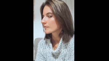Rinoplastia - Dr. Zuccardi Santiago