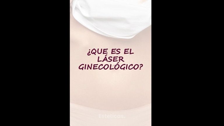 Láser ginecológico - Dra. Hebe Blanco