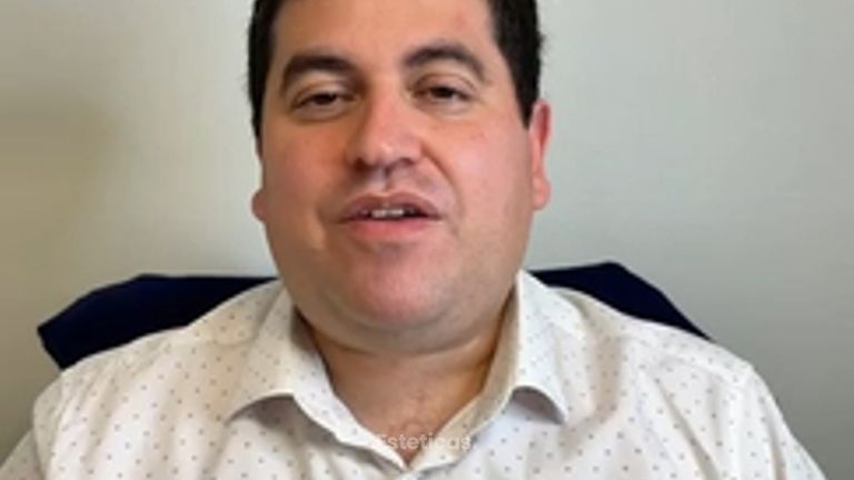 Testimonio paciente Rinoplastia - Dr. Rodolfo Villavicencio