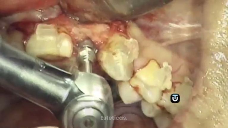 Solucionamos tus problemas dentales