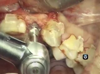 Solucionamos tus problemas dentales