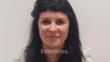 Rinoplastia - Dr. Lucas Sánchez