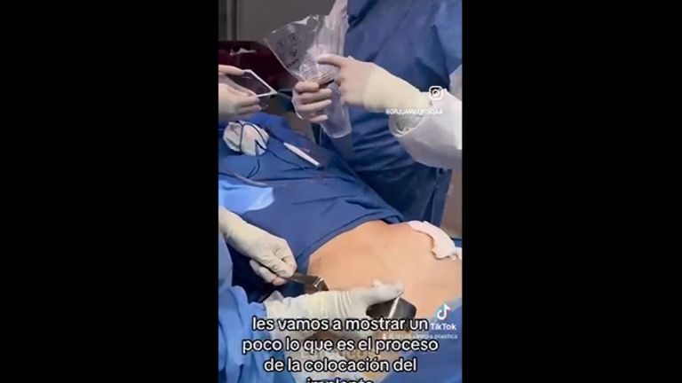 Aumento mamas - Dr. Juan Martín Saá