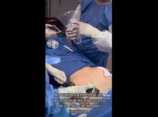 Aumento mamas - Dr. Juan Martín Saá