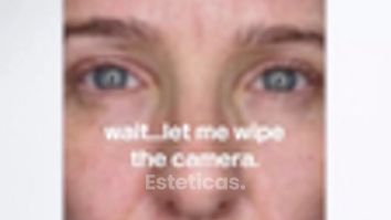 ¿Y si pudieras rejuvenecer tu mirada sin cambiar tu cara ? - Dra. Jimena D. Frasso