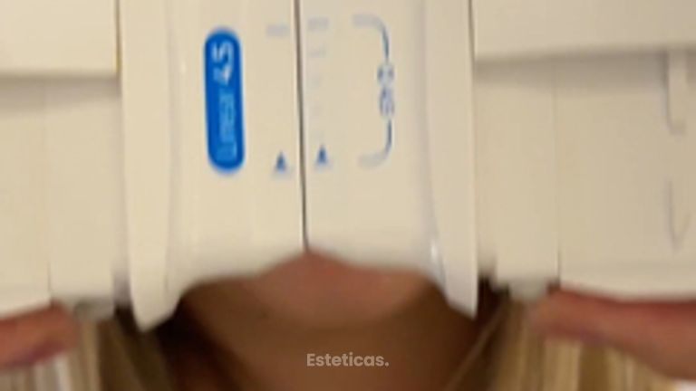 ¿Papada? Ultracell Q+ (HIFU) sin cirugía | Alma Estética Belgrano