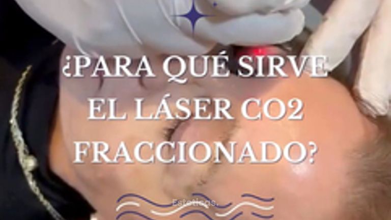 Láser CO2 - Dr. Agustín Matia