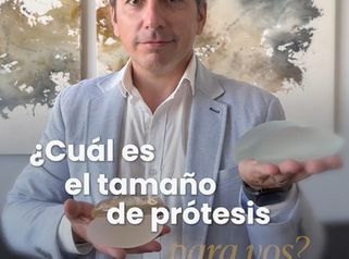 ¿Cuál es el tamaño de prótesis para vos? - Dr. Alejandro J Merello Abente