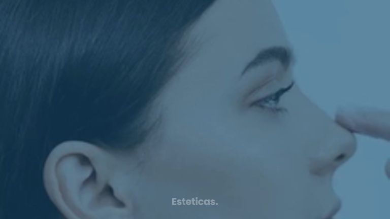 Beneficios de la Rinomodelación - Estetica Casal