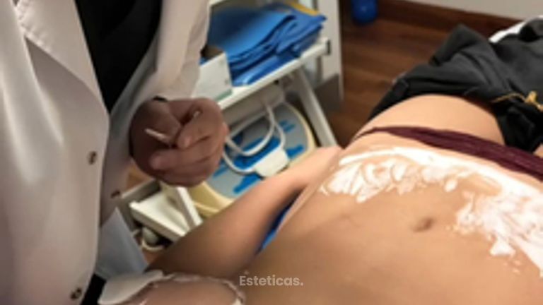 ¿Una cicatriz quirúrgica puede seguir mejorando? - Galeazzo Cirugia & Estetica