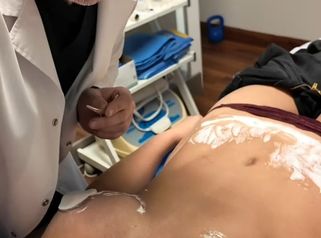 ¿Una cicatriz quirúrgica puede seguir mejorando? - Galeazzo Cirugia & Estetica
