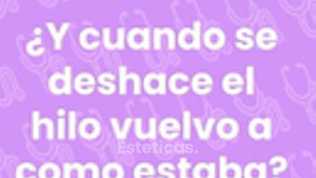 Hilos tensores - Y cuando se deshace el hilo vuelve a como estaba? - Dra. Jimena D. Frasso