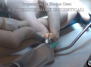 Solucionamos tus problemas en la dentadura