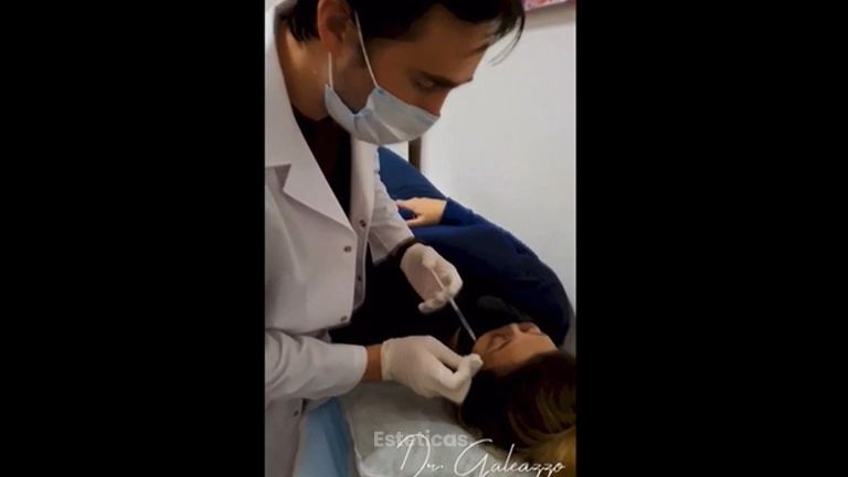 Botox - Dr. Damián Galeazzo