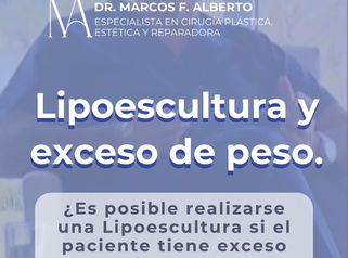 Lipoescultura - Dr. Marcos F. Alberto