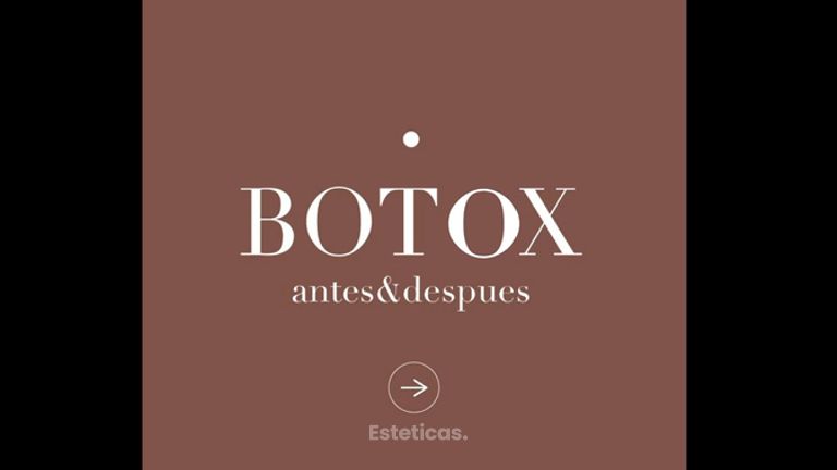 Botox - Dr. Héctor Martínez Gomez