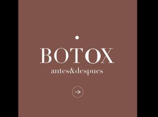 Botox - Dr. Héctor Martínez Gomez