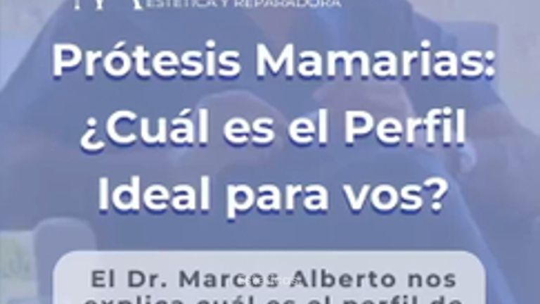 Prótesis mamarias - Dr. Marcos F. Alberto