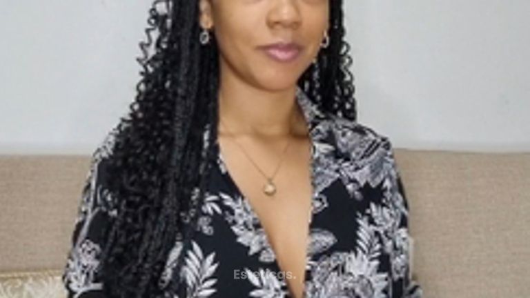 Hialuronidasa y relleno de labios - Dra. Haylen Solarte