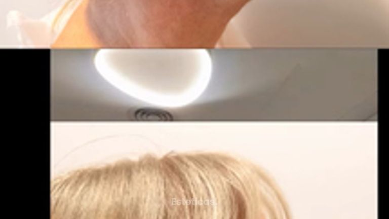 Testimonio paciente feliz Lifting - Bioestética Group