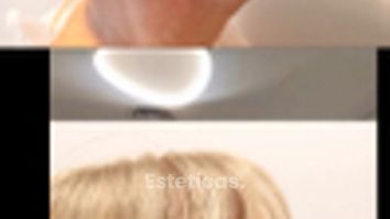 Testimonio paciente feliz Lifting - Bioestética Group