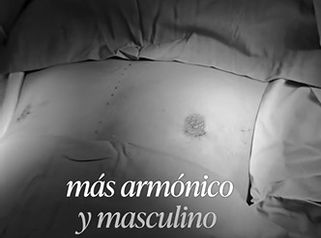 Ginecomastia - Dra. Natalia Solimano