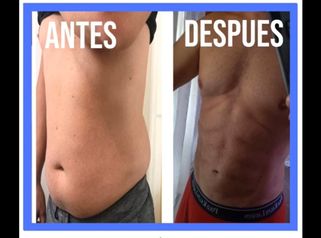 Abdominoplastia 