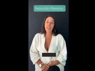 Reducción mamaria - Dr. Cristian Gänsslen